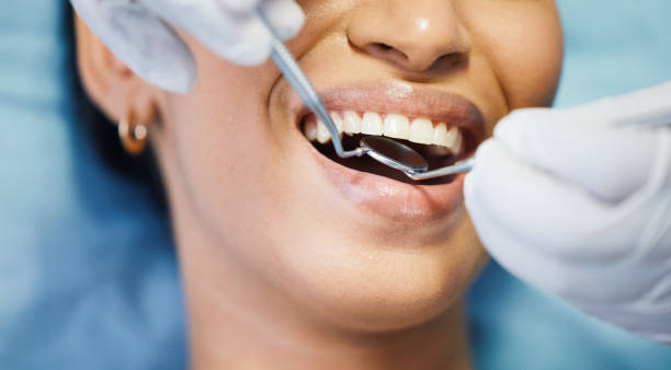 Best Emergency Denture Repair in River Heights, UT